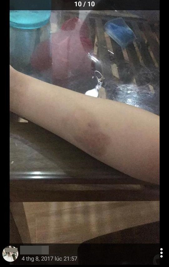 Vụ lùm xùm gây sốt nhất hôm nay: Hot girl yêu 3 năm cắm sừng bạn trai 7 lần, có bầu 5 tháng vẫn ngủ với trai lạ Vụ lùm xùm gây sốt nhất hôm nay: Hot girl yêu 3 năm cắm sừng bạn trai 7 lần, có bầu 5 tháng vẫn ngủ với trai lạ